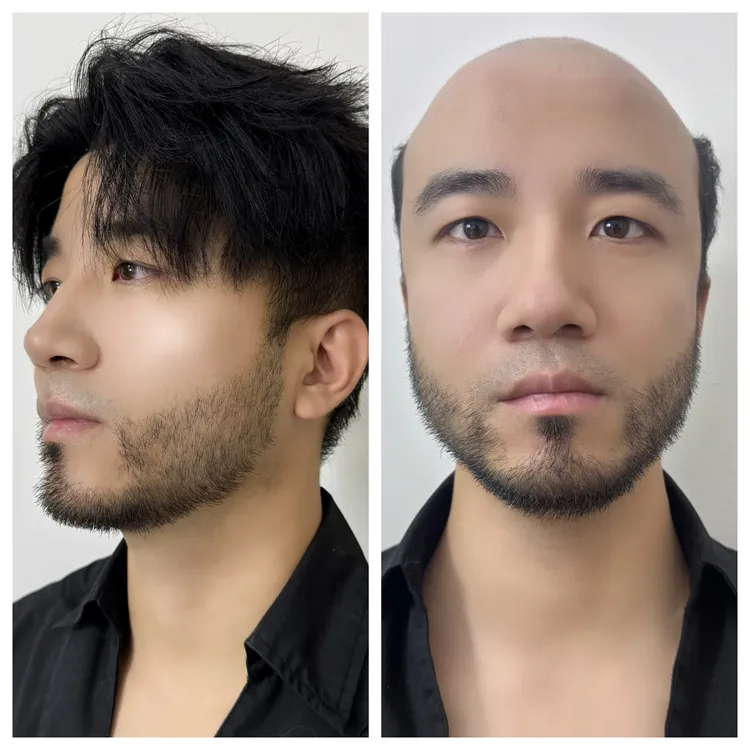 全递针生物天花板高质量男士额头刘海假发片头顶男士