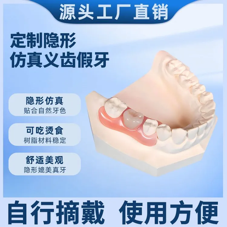 定缺牙牙套隐形义齿遮丑门牙仿真假牙缺牙少牙镶牙义齿种植临时牙
