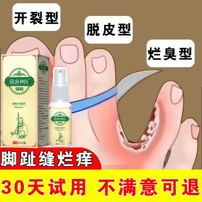【用好上万人】去脚痒脚臭干裂裂脱皮脚脚趾缝痒喷剂止痒克星起水泡