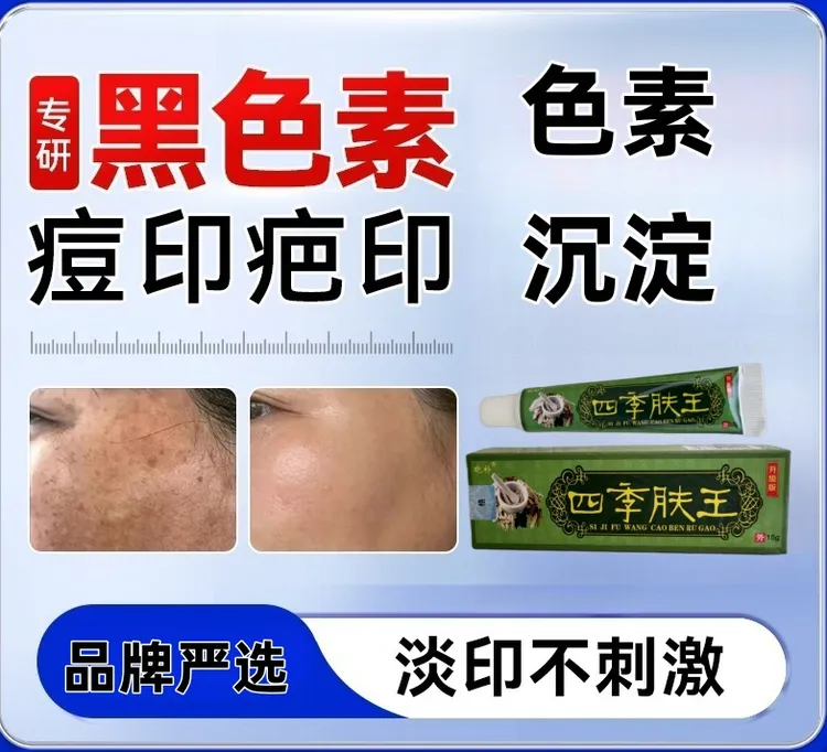 四季肤王皮肤去黑印黑色素去印痘印脸上斑点黑色素沉淀怎么去除