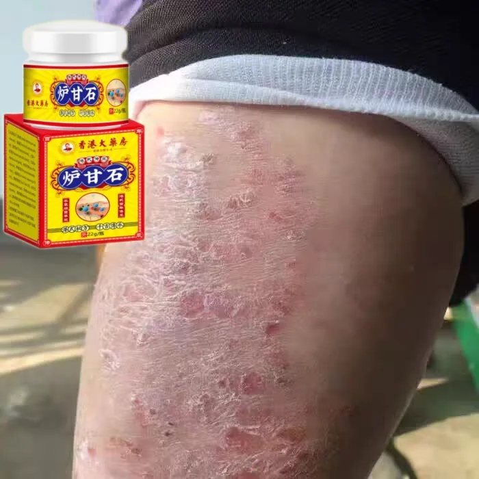 炉甘石软膏抑菌乳膏 家用护理止痒草本一次性外用涂抹快速原装