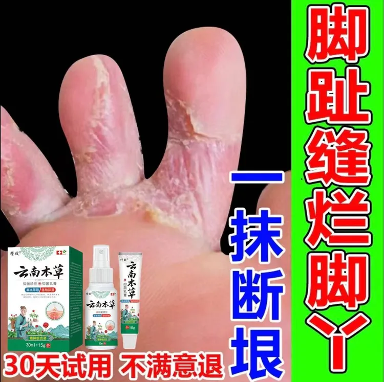脚趾缝痒专用去脚痒脚臭气止痒神器脚丫脱皮抑菌膏开裂克星喷雾剂
