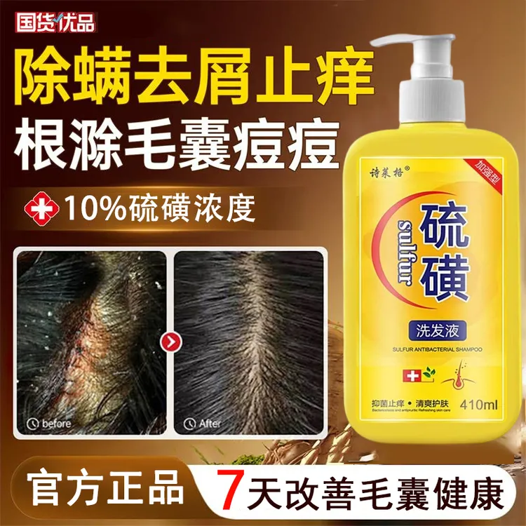 硫磺洗发水去屑止痒头皮螨虫痘痘毛囊头痒除螨控油头虱上海洗头膏