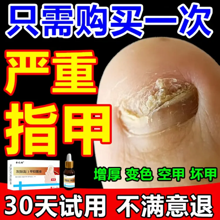 严重趾甲灰专用液亮甲特效正品抑菌液发灰发黄脚指甲根制专用特效