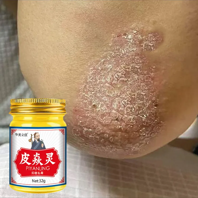 胳膊上起疙瘩潮湿痒身上痒起皮小疙瘩痒草本百痒膏快速