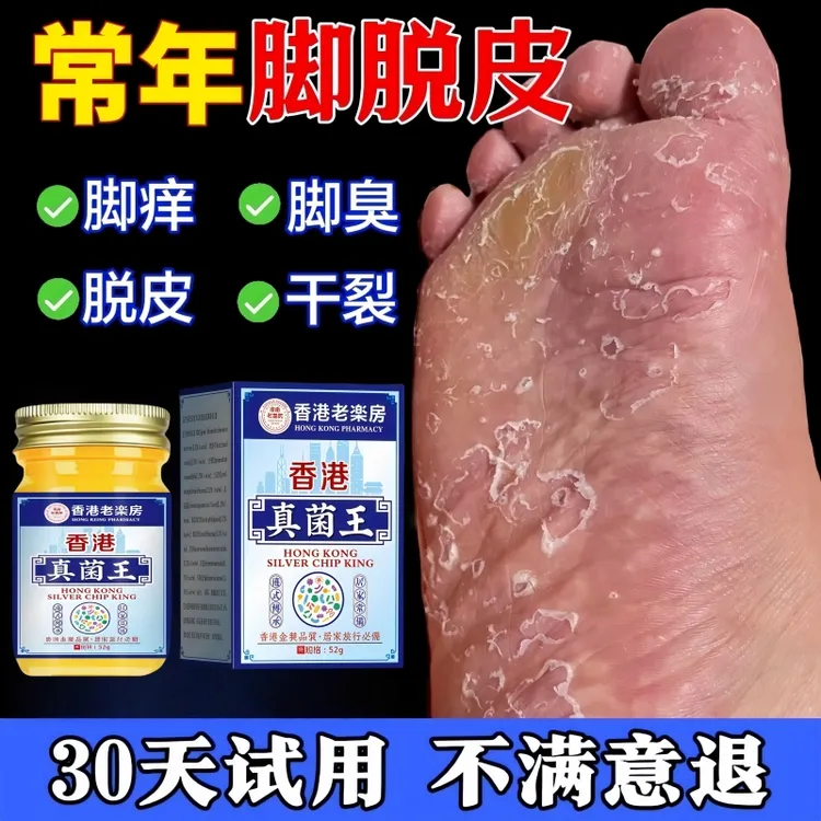 脚趾缝烂痒去脚痒脚臭气止痒神器脚丫水泡脱皮开裂克星真菌王乳膏