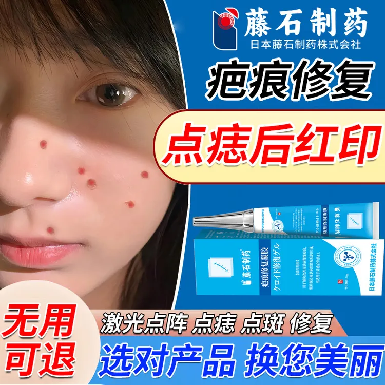 藤石制药点斑红印修复产品疤痕增生去坑疤痕膏激光点阵修复产品激光点阵掉痂后修复产品修复凝胶疤痕修复凝胶N3