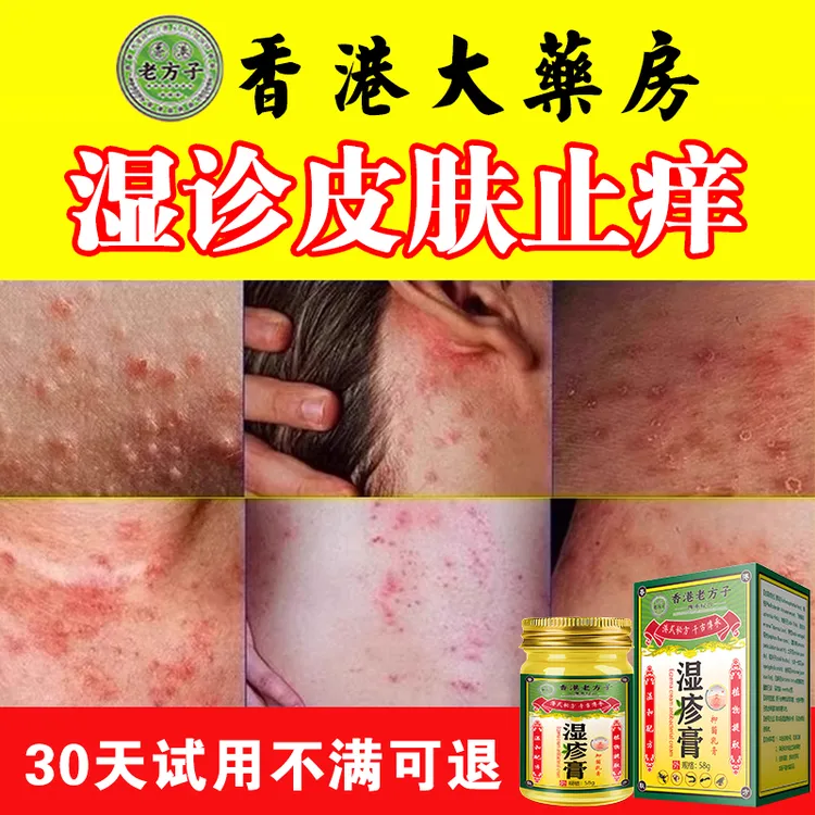 湿疹根去外用全身痒皮肤抑菌大腿内侧肛门瘙痒男士私处百草止痒膏