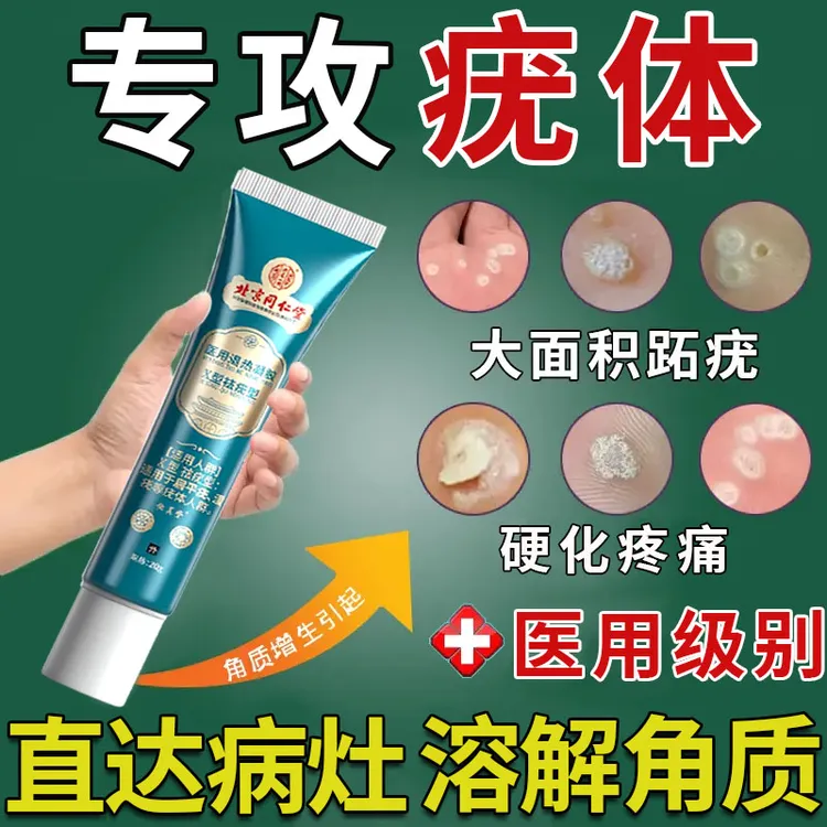 北京同仁堂扁平疣怎么去 除肉粒疙瘩专用扁平疣专用乳膏丝状疣专用乳膏脖子上长小肉揪揪是怎么回事内廷上用医用退热凝胶 