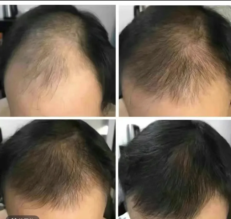 桃仁护发油qaq uzuk may