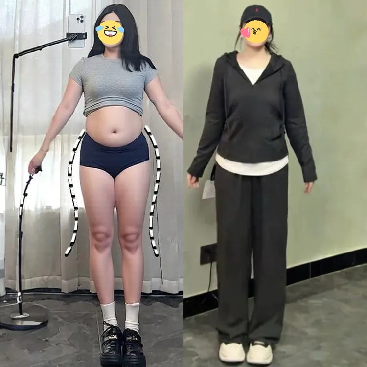 大码假两件上衣套装女秋季胖MM梨型身材穿搭遮肚显瘦休闲裤两件套