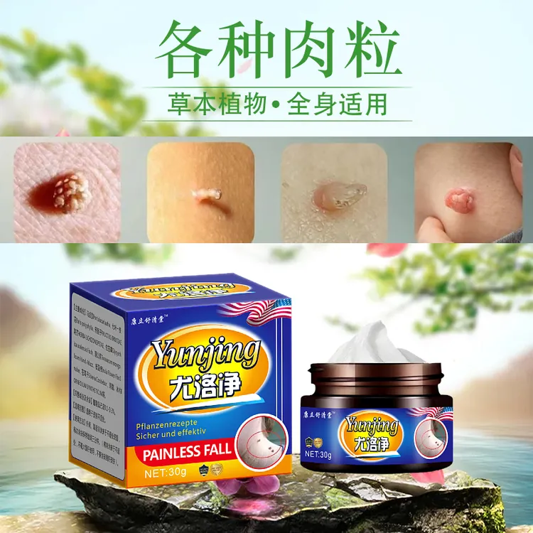 【小肉粒优膏】尤洛净尤膏草本萃取多人群适用涂抹外用乳膏