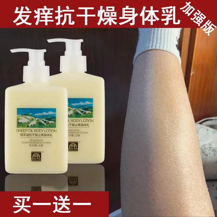 皮肤干燥起皮脱皮止痒滋润鱼鳞身体乳男女干皮腿上保湿脸部老年人