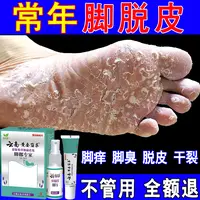 脚脱皮脚痒干裂真菌特效专用膏脚臭喷雾克星止痒神器脚底趾缝脱皮