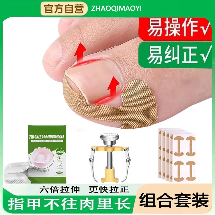 甲沟矫正神器嵌甲矫正贴片指甲往肉里长专用隔离纠正脚趾甲填充垫