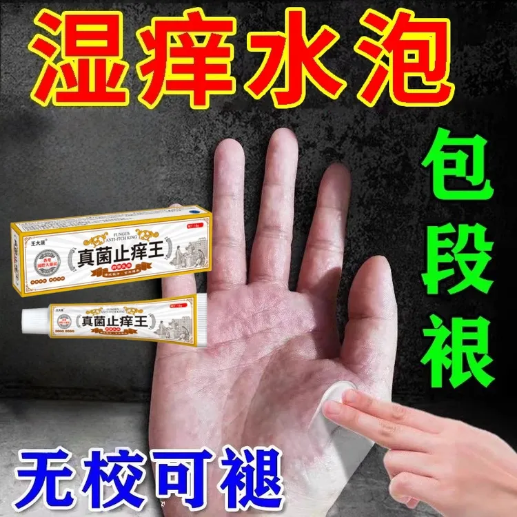 正品真菌王止痒膏香港国际大药房全身痒手脚指趾缝痒脱皮小水泡痒