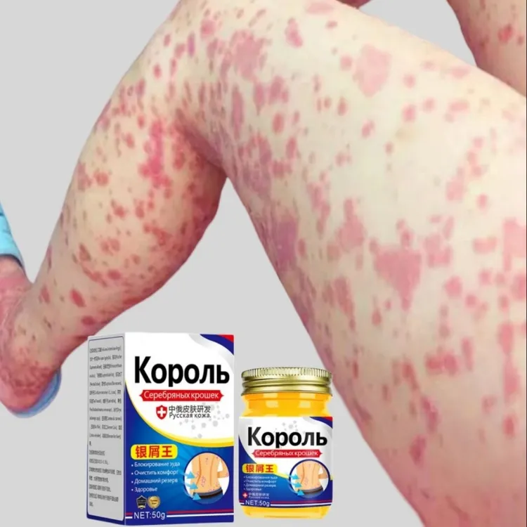 俄罗斯百想膏拍草本痒膏皮肤全身适用50克