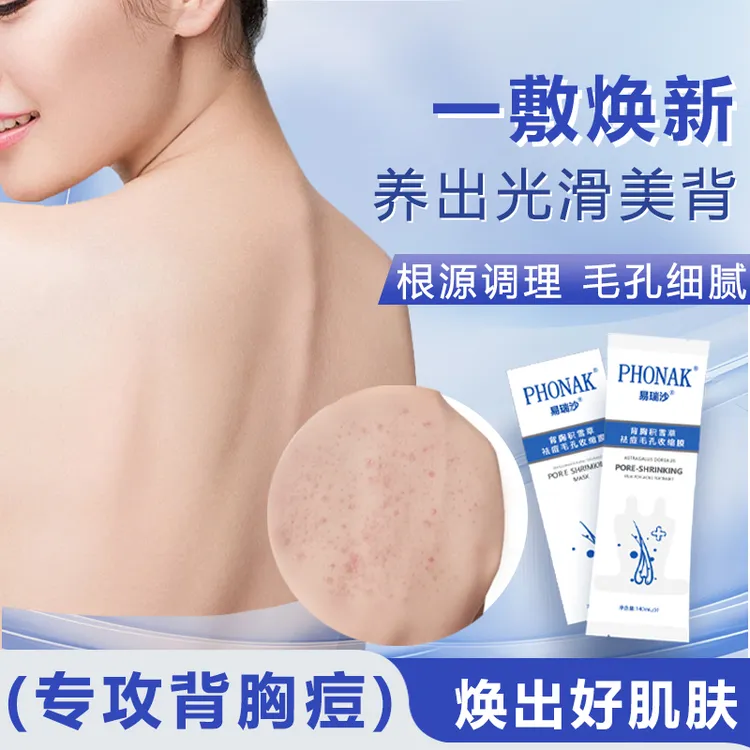 易瑞沙背膜祛痘补水焕肤粉刺前胸后背痘痘控油舒缓清痘修护痘肌