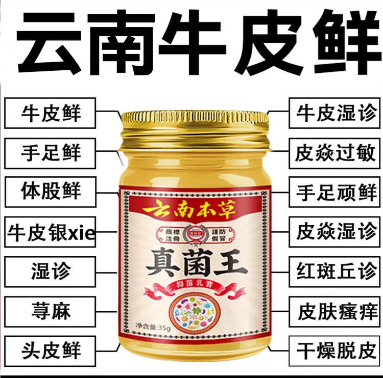 【云南真菌王】银屑去痒拔毒真菌王牛皮痒全身手足痒大腿内侧止痒