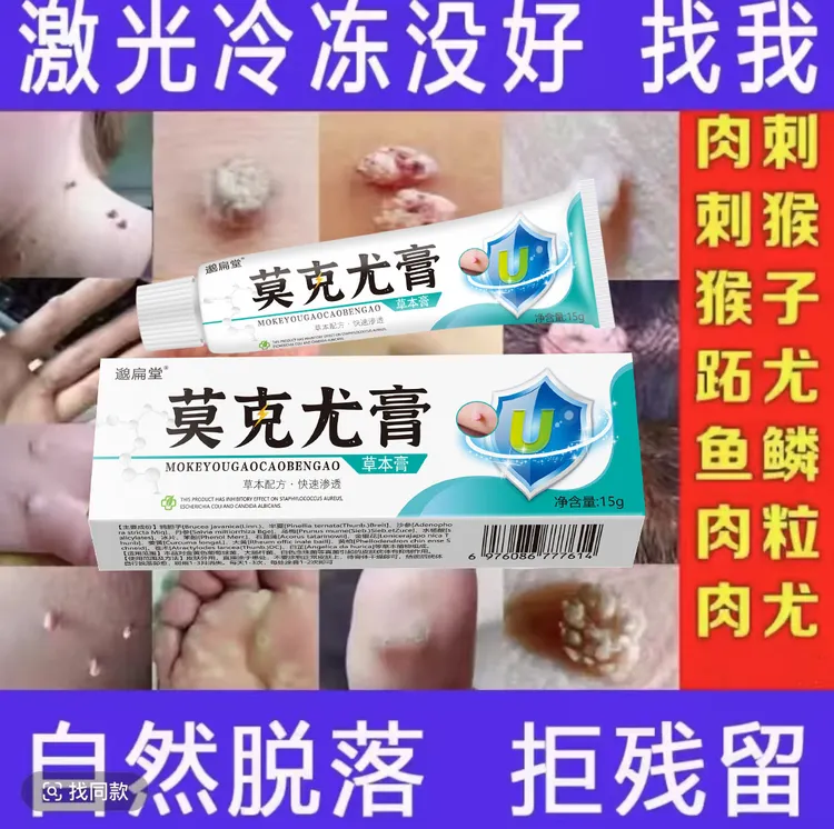 【小肉粒一点无忧】正品莫克尤膏脖子丝状扁平寻常肉刺手足腋下膏