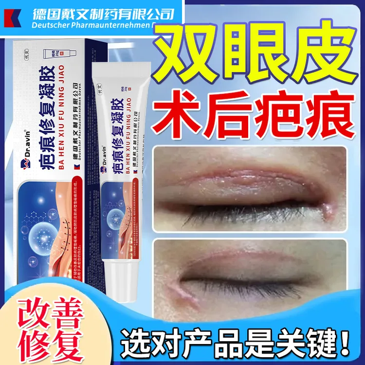 代文双眼皮手术疤痕膏凹陷疤痕增生疤痕改善修复疤痕预防疤痕形成疤痕修复凝胶