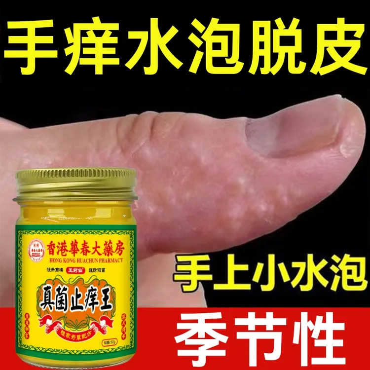 真菌止痒王手上痒起小水萢止痒膏脚趾缝烂手脱皮开裂克星抑菌软膏