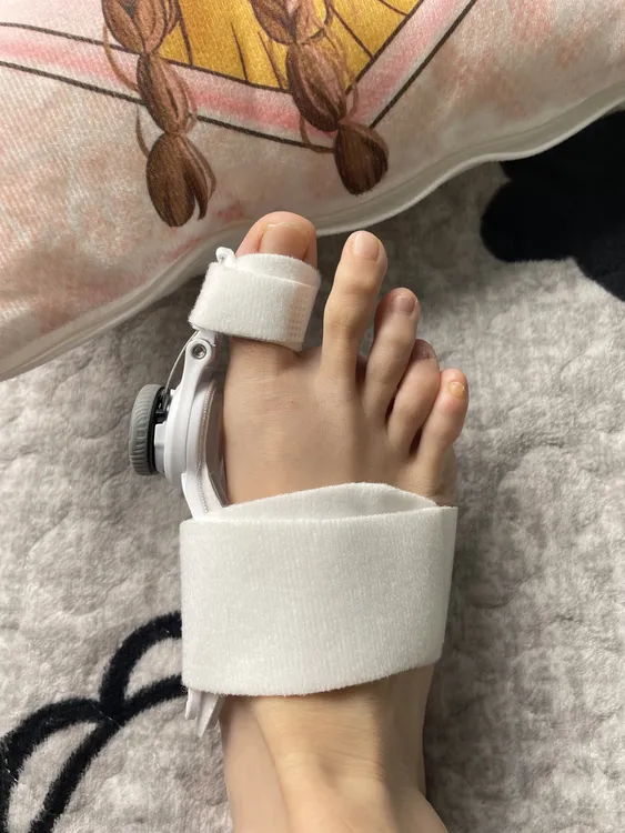 大脚骨拇趾外翻矫正器旋钮款升级夜用大脚趾矫形拇指分离器