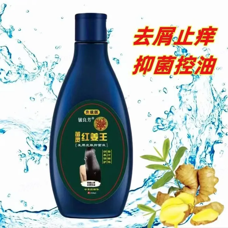 红姜王去屑止痒控油洗发水头皮毛囊洗发膏清爽去屑痒油