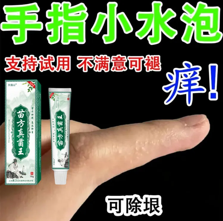 手指长小水泡手部手足脱皮痒手指开裂手指脱皮手足起汗抑菌软膏