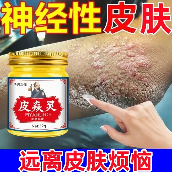 【神经性皮焱】无校包退全身可用脂溢性皮肤日光性皮肤痒止痒抑菌膏