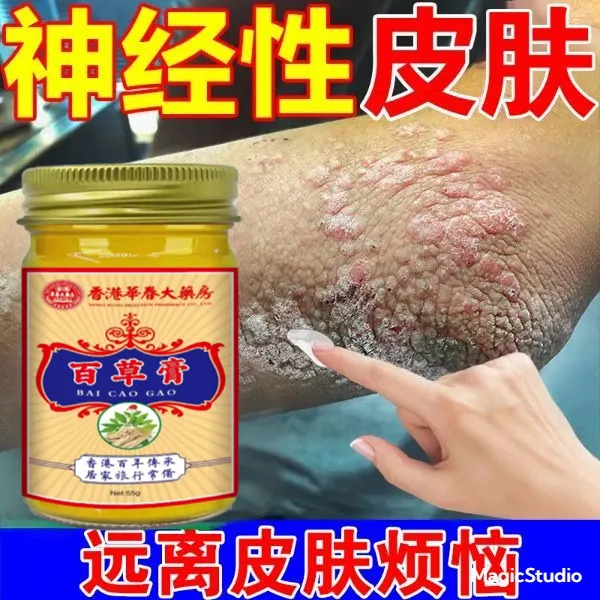 【神经性皮焱】无用包退脂溢性皮焱皮肤瘙痒全身可用草本止痒抑菌膏