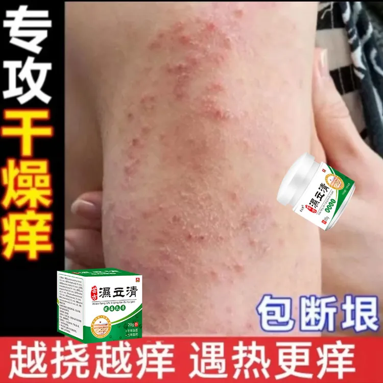 皮肤湿痒止痒季节性瘙痒红肿硬疙瘩全身痒起皮干痒草本外用乳膏