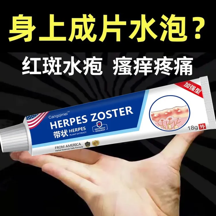 带状泡疹后遗神经痛蛇盘疮膏蛇盘清缠腰龙生 直器泡专用外用膏