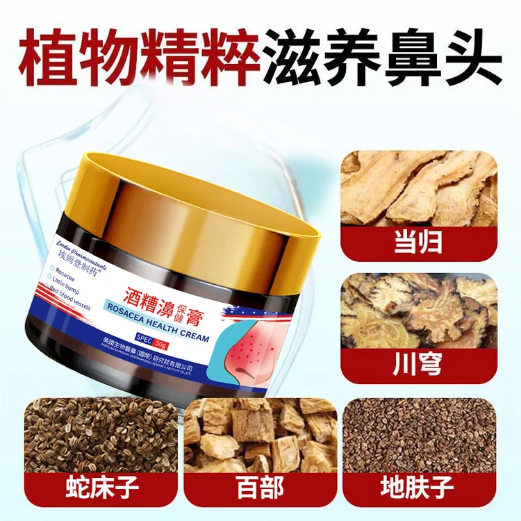 正品酒渣鼻红鼻子螨虫鼻大鼻子粉刺红血丝草莓鼻涂抹膏毛孔粗大J