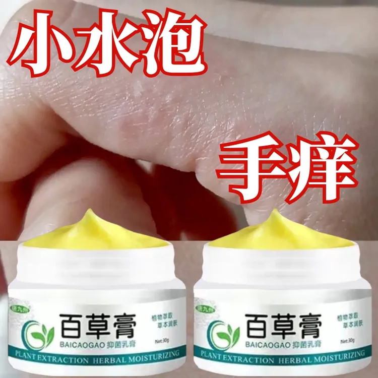 手指缝脱皮干裂痒专用手上脚上起小水泡止痒膏手足汗状泡抑菌乳膏