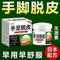 手指头脱皮起干皮手干裂手掌心脱皮起硬皮手足脱皮变硬外用涂抹膏