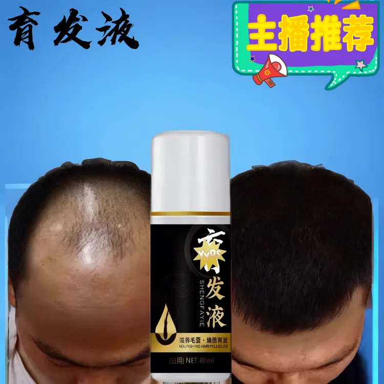育发液头发际线生长增密头发固发日用夜用男女生毛攘防脱浓密喷雾