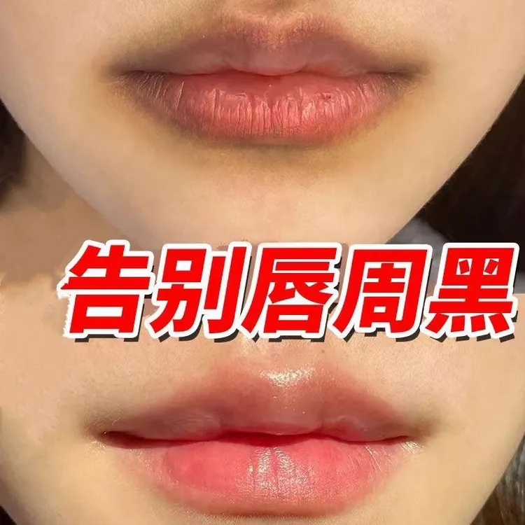 去唇周黑嘴角暗沉黑色素沉淀去除改善产品唇部提亮淡纹润唇V精华