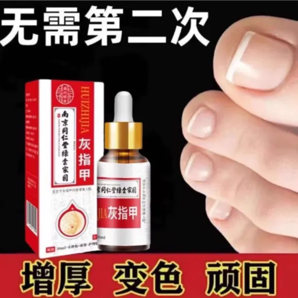 咴（趾）指甲护理灰脚手指专用亮甲凤仙花软甲修护指甲抑菌液