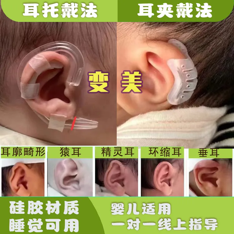 新生儿耳朵矫正神器婴儿耳廓定型贴硅胶招风耳塑形耳朵压扁矫正