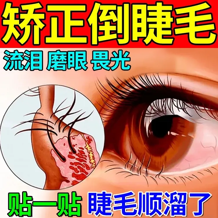 儿童倒睫毛矫正贴零感觉超薄上眼睑提拉神器改善倒睫毛防眼睑下垂