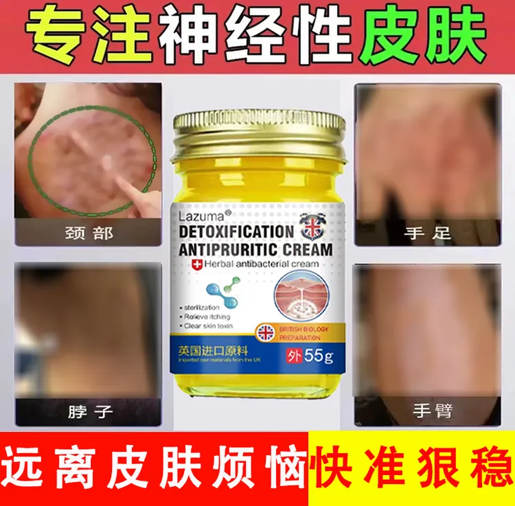 神经性皮肤日光性皮肤全身可用草本精华抑菌清凉舒适外用涂抹乳膏
