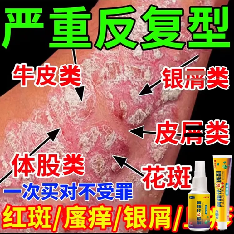 【闹闹推荐】黄柏祛廯搽剂升级组合套装乳膏喷搽剂皮肤外用草本乳膏