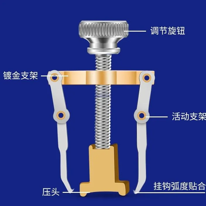 甲沟矫正神器嵌甲指甲纠正器卷甲矫正器防脚指甲长肉里修脚工具炎