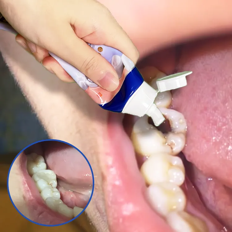 【牙膏界的佼佼者】德国牙膏牙黄牙黑敏感大牌护理牙膏