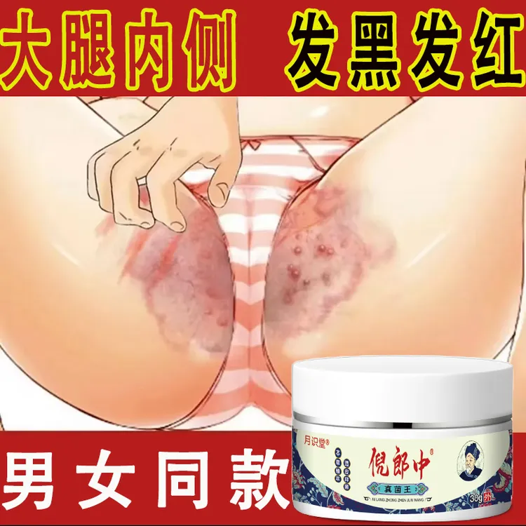 【倪郎中真菌王】大腿内侧腌裆阴囊潮湿外阴瘙痒异味难闻草本抑菌膏