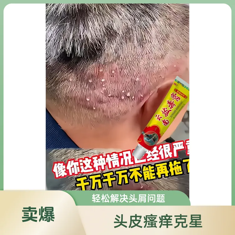 脸上起疙瘩湿痒个人护理温和百草毛囊膏拔毒膏草本止痒抑菌修护
