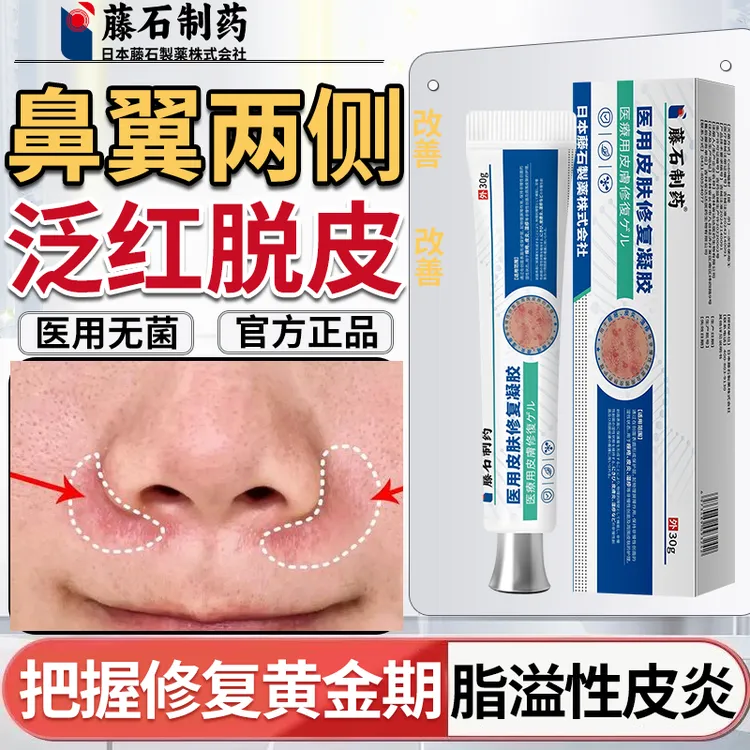 藤石制药鼻子两侧脂溢性皮炎专用鼻沟发红鼻子两侧泛红修复霜膏干燥起皮脱皮化妆卡粉药监备案皮肤屏障受损医用皮肤修复凝胶Q2