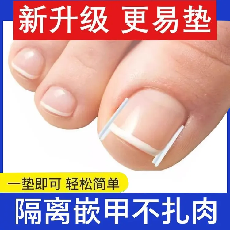 甲沟矫正神器指甲嵌甲专用隔离垫片脚趾甲往肉里长纠正甲贴炎甲扣