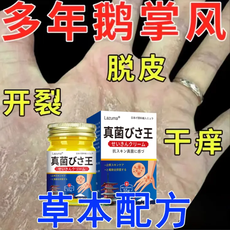 鹅掌风手足干裂脱皮克星草本抑菌膏四季修护神器抑菌止痒涂抹乳膏